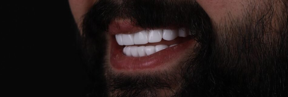 Final side view result after Hollywood Smile for chipped and missing teeth